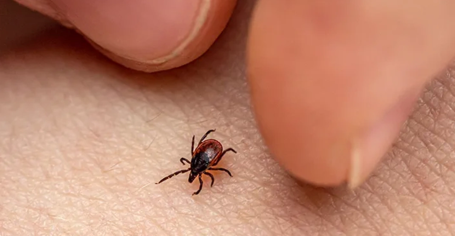 Tick Borne Diseases and Oral Health INBLOG